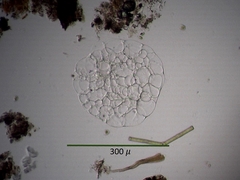 Actinosphaerium