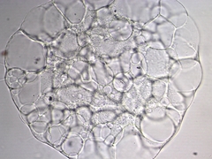Actinosphaerium