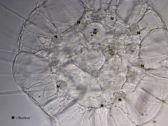 Actinosphaerium
