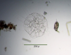 Actinosphaerium