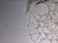 Actinosphaerium