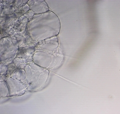 Actinosphaerium