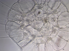 Actinosphaerium
