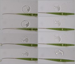 Actinosphaerium
