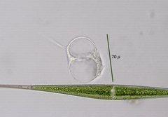 Actinosphaerium