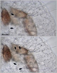 Actinosphaerium eichhornii