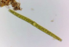 Pleurotaenium trabecula