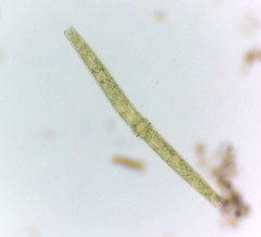 Pleurotaenium trabecula