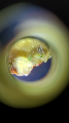 Aphididae