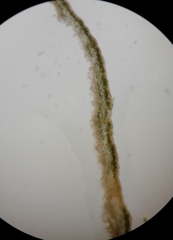 Leptogium laceroides