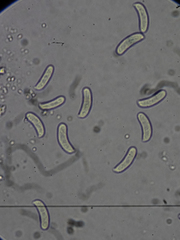 Vuilleminia comedens