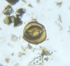 Quinqueloculina