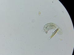 Chaetonotida