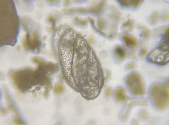 Buliminella elegantissima