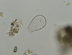 Quadrulella symmetrica