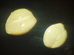 Quinqueloculina
