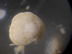 Gavelinopsis isabelleana