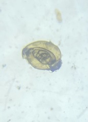 Quinqueloculina
