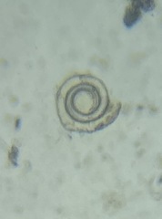 Cornuspira involvens