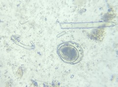 Patellina corrugata