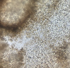 Elaphomyces muricatus