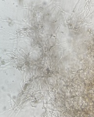 Elaphomyces muricatus