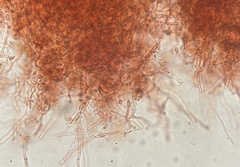 Elaphomyces muricatus