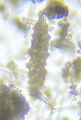 Astrorhizina