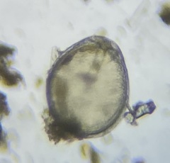 Fissurina