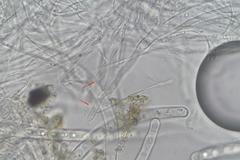 Sarcoscypha vassiljevae