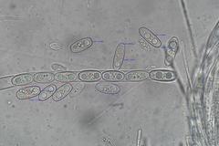 Sarcoscypha vassiljevae