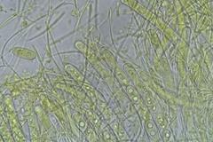 Sarcoscypha vassiljevae