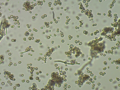 Chaenotheca gracillima