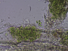 Chaenotheca gracillima