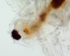 Colacium vesiculosum