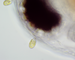 Colacium vesiculosum