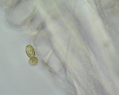 Colacium vesiculosum