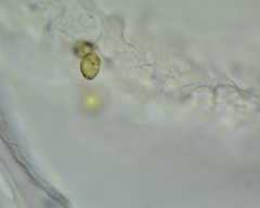 Colacium vesiculosum