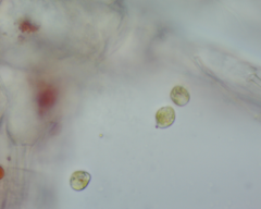 Colacium vesiculosum