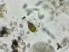 Trachelomonas hexangulata