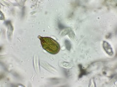 Trachelomonas hexangulata