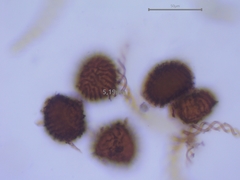Fossombronia wondraczekii
