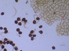 Fossombronia wondraczekii