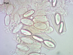 Peziza echinospora