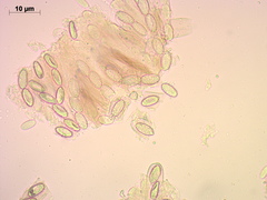 Peziza echinospora