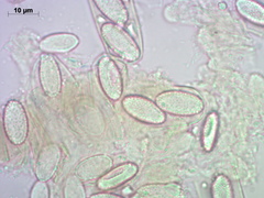 Peziza echinospora