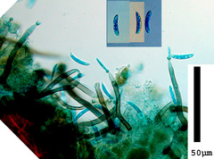 Dictyochaeta simplex