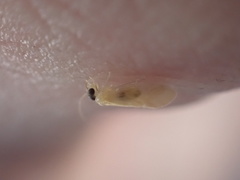 Valenzuela indicator