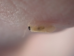 Valenzuela indicator