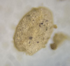 Miliammina fusca